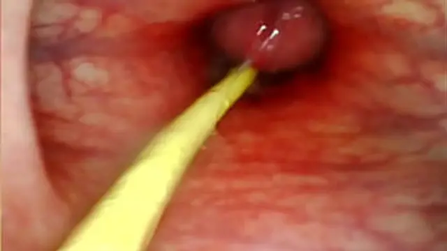 INTIMATE ANAL👌 VIEW AS I SHOVEL HER WITH MY LARGE DICK🍆 AND SPLASH DEEP INSIDE