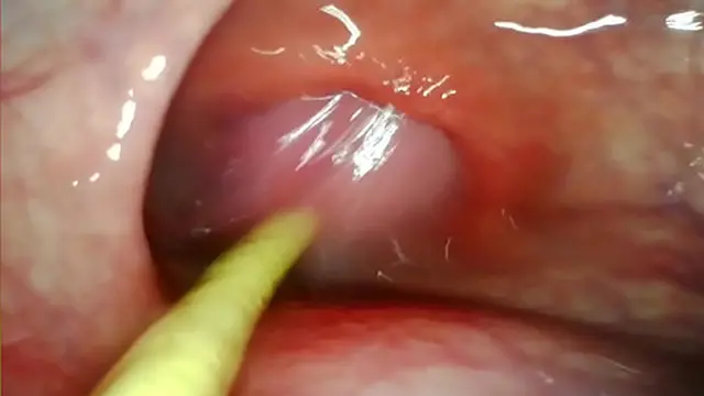 Deep inside her hole &mdash;  my big cock🍆 drives hard &mdash;  cumshot flooding her ass🍑