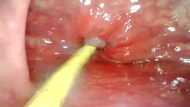 Deep throat creampie cumshot creampie creampie creampie creampie creampie creampie creampie creampie