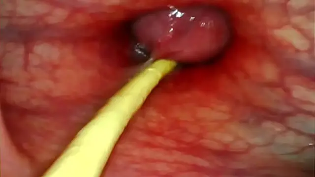 EXTREME ANAL POV  CAMERA INSIDE HER ASSHOLE AS I POUND HER WITH MY BIG COCK AND CUM DEEP INSIDE