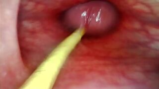 ANAL POV. CAMERA INSIDE HER ASSHOLE AS I POUND HER WITH MY BIG COCK AND CUM DEEP INSIDE